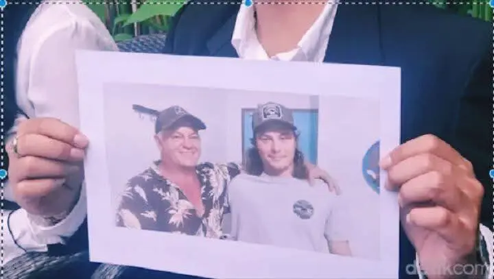 Rumah Sakit Bali Berikan Penjelasan Soal Jantung Turis Australia