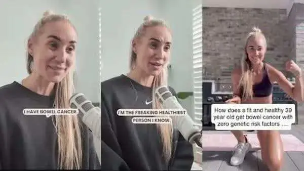 Viral Wanita Kena Kanker Usus Stadium 2 di Usia 39, Dikira Cuma Kelelahan Biasa