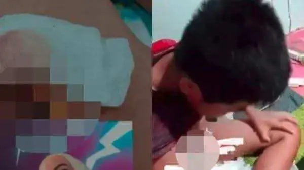 Viral Bocah Korban Salah Sunat, Kemaluannya Terpotong Pakai Laser: Bupati Marah Suruh Lapor Polisi