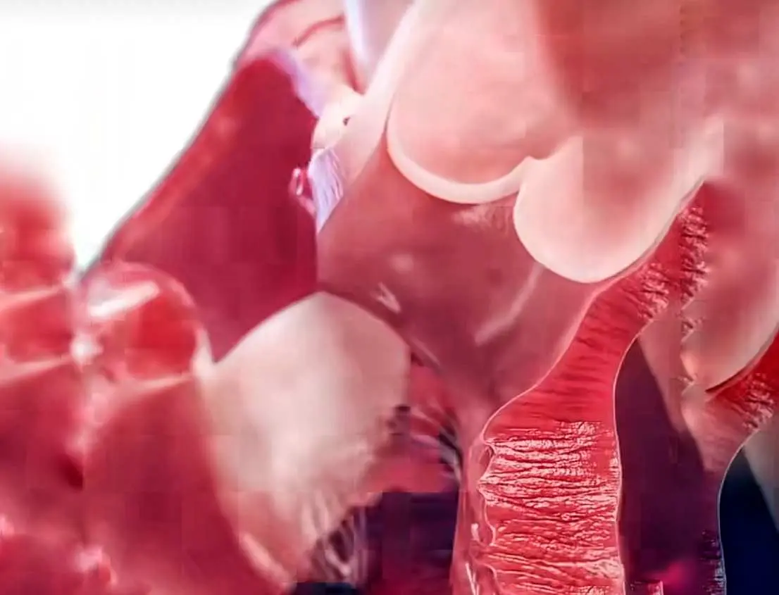 Waspada, Ini Daftar 5 Penyebab Umum Kematian Mendadak pada Orang Muda!