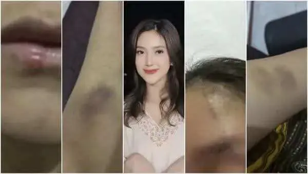 Suami Adelia Septa Ditahan Jadi Tersangka KDRT, Terancam 5 Tahun Penjara